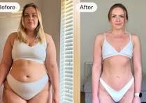Side by side before and after photo of a woman in white underwear showing weight loss progress labeled Before and After